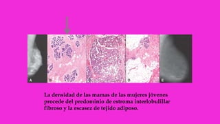La densidad de las mamas de las mujeres jóvenes
procede del predominio de estroma interlobulillar
fibroso y la escasez de tejido adiposo.
 