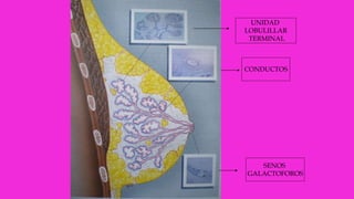 UNIDAD
LOBULILLAR
TERMINAL
CONDUCTOS
SENOS
GALACTOFOROS
 