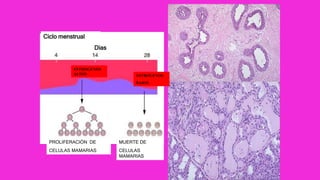 Ciclo menstrual
Dias
ESTROGENOS
ALTOS ESTROGENOS
BAJOS
PROLIFERACIÓN DE
CELULAS MAMARIAS
MUERTE DE
CELULAS
MAMARIAS
 