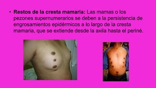 • Restos de la cresta mamaria: Las mamas o los
pezones supernumerarios se deben a la persistencia de
engrosamientos epidérmicos a lo largo de la cresta
mamaria, que se extiende desde la axila hasta el periné.
 