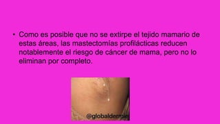 • Como es posible que no se extirpe el tejido mamario de
estas áreas, las mastectomías profilácticas reducen
notablemente el riesgo de cáncer de mama, pero no lo
eliminan por completo.
 