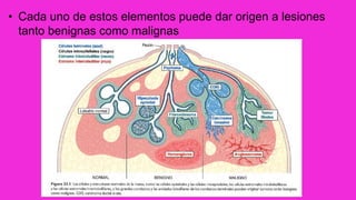 • Cada uno de estos elementos puede dar origen a lesiones
tanto benignas como malignas
 