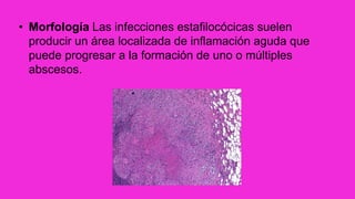 • Morfología Las infecciones estafilocócicas suelen
producir un área localizada de inflamación aguda que
puede progresar a la formación de uno o múltiples
abscesos.
 