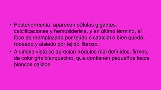 • Posteriormente, aparecen células gigantes,
calcificaciones y hemosiderina, y en último término, el
foco es reemplazado por tejido cicatricial o bien queda
rodeado y aislado por tejido fibroso.
• A simple vista se aprecian nódulos mal definidos, firmes,
de color gris blanquecino, que contienen pequeños focos
blancos calizos.
 