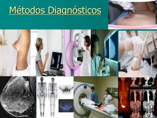 Métodos Diagnósticos
 