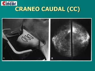 CRANEO CAUDAL (CC)
 