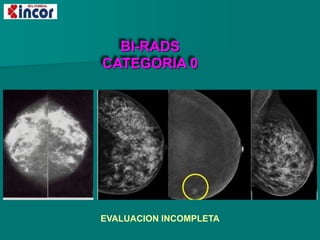 BI-RADS
CATEGORIA 0
EVALUACION INCOMPLETA
 