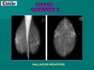 BI-RADS
CATEGORIA 1
HALLAZGOS NEGATIVOS
 