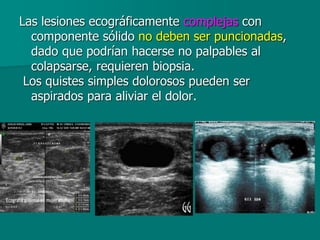 Las lesiones ecográficamente complejas con
componente sólido no deben ser puncionadas,
dado que podrían hacerse no palpables al
colapsarse, requieren biopsia.
Los quistes simples dolorosos pueden ser
aspirados para aliviar el dolor.
 