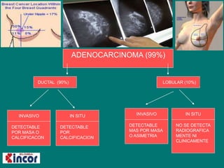 ADENOCARCINOMA (99%)
LOBULAR (10%)DUCTAL (90%)
INVASIVO IN SITU INVASIVO IN SITU
DETECTABLE
POR MASA O
CALCIFICACON
DETECTABLE
POR
CALCIFICACION
DETECTABLE
MAS POR MASA
O ASIMETRIA
NO SE DETECTA
RADIOGRAFICA
MENTE NI
CLINICAMENTE
 