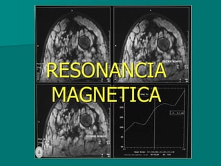 RESONANCIA
MAGNETICA
 