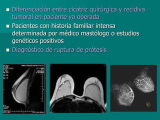  Diferenciación entre cicatriz quirúrgica y recidiva
tumoral en paciente ya operada
 Pacientes con historia familiar intensa
determinada por médico mastólogo o estudios
genéticos positivos
 Diagnóstico de ruptura de prótesis
 