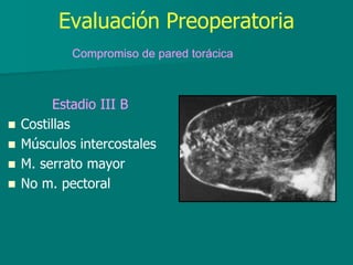 Evaluación Preoperatoria
Estadio III B
 Costillas
 Músculos intercostales
 M. serrato mayor
 No m. pectoral
Compromiso de pared torácica
 