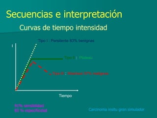 Secuencias e interpretación
Curvas de tiempo intensidad
Tipo I : Persitente 83% benignas
Tipo II : Plateau
Tipo III : Washout 57% malignas
I
Tiempo
91% sensibilidad
83 % especificidad Carcinoma insitu gran simulador
 