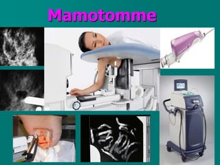Mamotomme
 