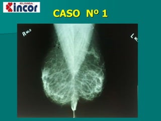 CASO Nº 1
 