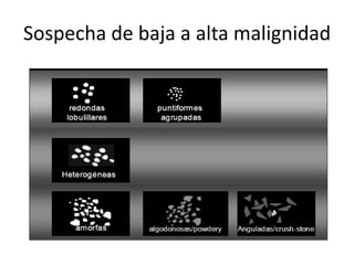 Sospecha de baja a alta malignidad