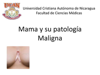 Universidad Cristiana Autónoma de Nicaragua Facultad de Ciencias Médicas Mama y su patología Maligna 