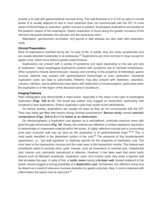 MAMC Radiology book Developmental Anomalies of GI Tract .pdf