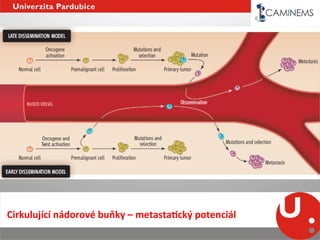 Cirkulující	
  nádorové	
  buňky	
  –	
  metastaEcký	
  potenciál	
  
 