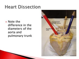  Note the
difference in the
diameters of the
aorta and
pulmonary trunk
 