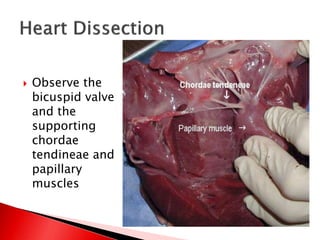  Observe the
bicuspid valve
and the
supporting
chordae
tendineae and
papillary
muscles
 