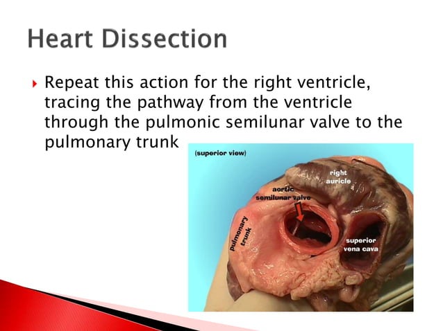 Mammal Heart Dissection | PPTX | Heart and Cardiovascular Diseases ...
