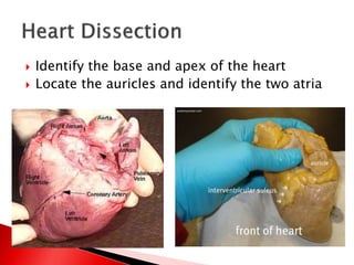  Identify the base and apex of the heart
 Locate the auricles and identify the two atria
 