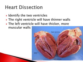  Identify the two ventricles
 The right ventricle will have thinner walls
 The left ventricle will have thicker, more
muscular walls
 