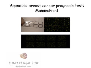Agendia’s breast cancer prognosis test:
             MammaPrint
 