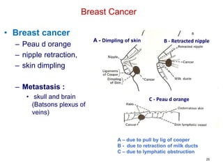 25
Breast Cancer
• Breast cancer
– Peau d orange
– nipple retraction,
– skin dimpling
– Metastasis :
• skull and brain
(Batsons plexus of
veins)
A - Dimpling of skin B - Retracted nipple
C - Peau d orange
A – due to pull by lig of cooper
B - due to retraction of milk ducts
C – due to lymphatic obstruction
 