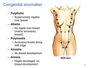 29
Congenital anomalies
– Polythelia
• Supernumery nipples
over breast
– Athelia
• No nipple over breast
(mainly accessory
breast)
– Polymastia
• Accessory breast along
milk ridge
– Amastia
• No breast development
– Amazia
• Nipple developed, no
breast development
 