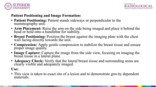 Mammography Positioning Guidebook.pdf MAMMGRAPHY PPT. 58,24, 100, .....106.pdf