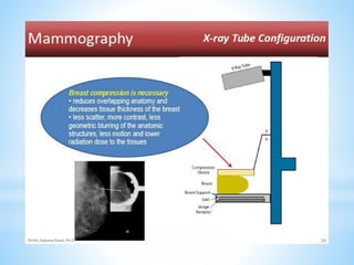 Role of mammography and MRI in Breast disorders | PPTX