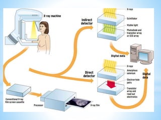 Role of mammography and MRI in Breast disorders | PPTX