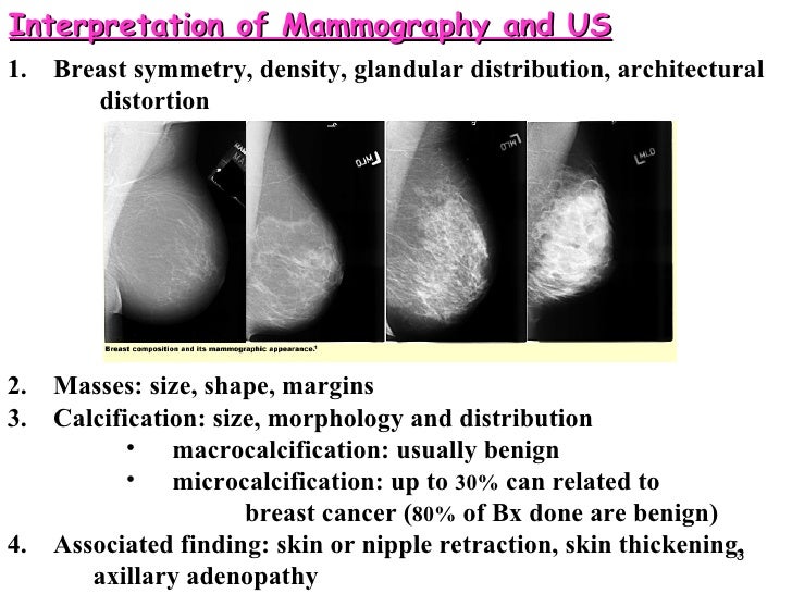 Mammogram