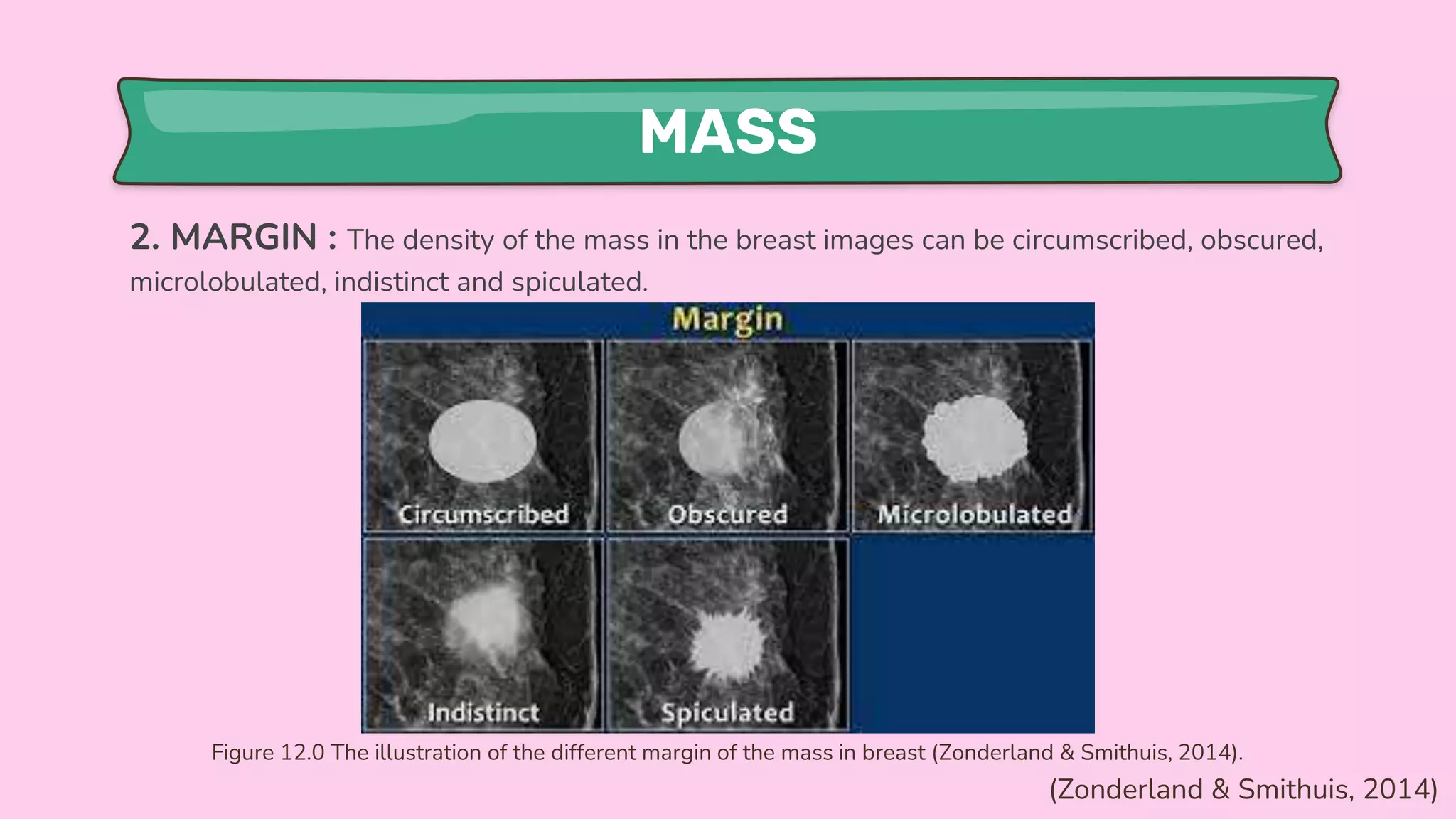 MASS
2. MARGIN : The density of the mass in the breast images can be circumscribed, obscured,
microlobulated, indistinct and spiculated.
Figure 12.0 The illustration of the different margin of the mass in breast (Zonderland & Smithuis, 2014).
(Zonderland & Smithuis, 2014)
 