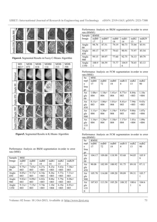 IJRET: International Journal of Research in Engineering and Technology eISSN: 2319-1163 | pISSN: 2321-7308
__________________________________________________________________________________________
Volume: 02 Issue: 10 | Oct-2013, Available @ http://www.ijret.org 73
Angle900Angle1350
Figure4. Segmented Results in Fuzzy C-Means Algorithm
MD
B017
MDB
072
MDB
018
MDB0
114
MDB
213
MDB
290
OriginalAngle00Angle450Angle900Angle1350
Figure5. Segmented Results in K-Means Algorithm
Performance Analysis on RKM segmentation in-order to error
rate (MSE)
Sample
Image
MSE
mdb0
17
mdb0
72
mdb0
18
mdb1
14
mdb2
13
mdb29
0
Angle
00
9.75e+
003
7.65e+
003
6.27e
+003
8.23e
+003
5.63e
+003
7.38e+
003
Angle
450
8.05e+
003
9.17e+
003
6.34e
+003
8.26e
+003
5.77e
+003
7.31e+
003
Angle
900
9.82e+
003
8.09e+
003
6.02e
+003
8.06e
+003
5.79e
+003
8.06e+
003
Angle
1350
9.11e+
003
7.15e+
003
5.74e
+003
1.10e
+004
6.18e
+003
6.91e+
003
Performance Analysis on RKM segmentation in-order to error
rate (RMSE)
Sample
Image
RMSE
mdb0
17
mdb07
2
mdb0
18
mdb1
14
mdb2
13
mdb29
0
Angle
00
98.76 87.51 79.19 90.73 75.04 85.91
Angle
450
89.17 95.77 79.63 90.91 75.97 85.54
Angle
900
99.15 89.97 77.60 92.75 76.13 89.79
Angle
1350
100.9
1
84.59 75.77 104.9
6
78.65 83.13
Performance Analysis on FCM segmentation in-order to error
rate (MSE)
Sa
mpl
e
Ima
ge
MSE
mdb0
17
mdb0
72
mdb0
18
mdb11
4
mdb2
13
mdb2
90
An
gle
00
1.08e+
004
1.18e+
004
1.41e+
004
8.77e+
003
8.84e
+003
1.10e
+004
An
gle
450
8.11e+
003
1.06e+
004
1.01e+
004
8.41e+
003
7.94e
+003
9.43e
+003
An
gle
900
1.11e+
004
1.30e+
004
1.19e+
004
9.97e+
003
9.86e
+003
1.07e
+004
An
gle
135
0
1.16e+
004
1.29e+
004
1.10e+
004
1.17e+
004
1.01e
+004
1.09e
+004
Performance Analysis on FCM segmentation in-order to error
rate (RMSE)
Sa
mpl
e
Ima
ge
RMSE
mdb0
17
mdb0
72
mdb0
18
mdb11
4
mdb2
13
mdb2
90
An
gle
00
104.17 109.00 118.99 93.68 94.05 105.9
9
An
gle
450
90.08 102.99 100.92 91.75 89.10 97.11
An
gle
900
105.78 114.08 109.20 99.89 99.31 103.7
1
An
gle
135
0
107.83 113.58 105.20 108.32 100.6
1
104.6
6
 
