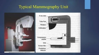 Mammogram Slides mammogram ppt on the priciples and application of mammogram | PPTX