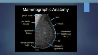 Mammogram Slides mammogram ppt on the priciples and application of mammogram | PPTX