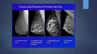 Mammogram Slides mammogram ppt on the priciples and application of mammogram | PPTX