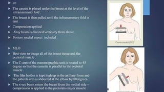 Mammogram Slides mammogram ppt on the priciples and application of mammogram | PPTX