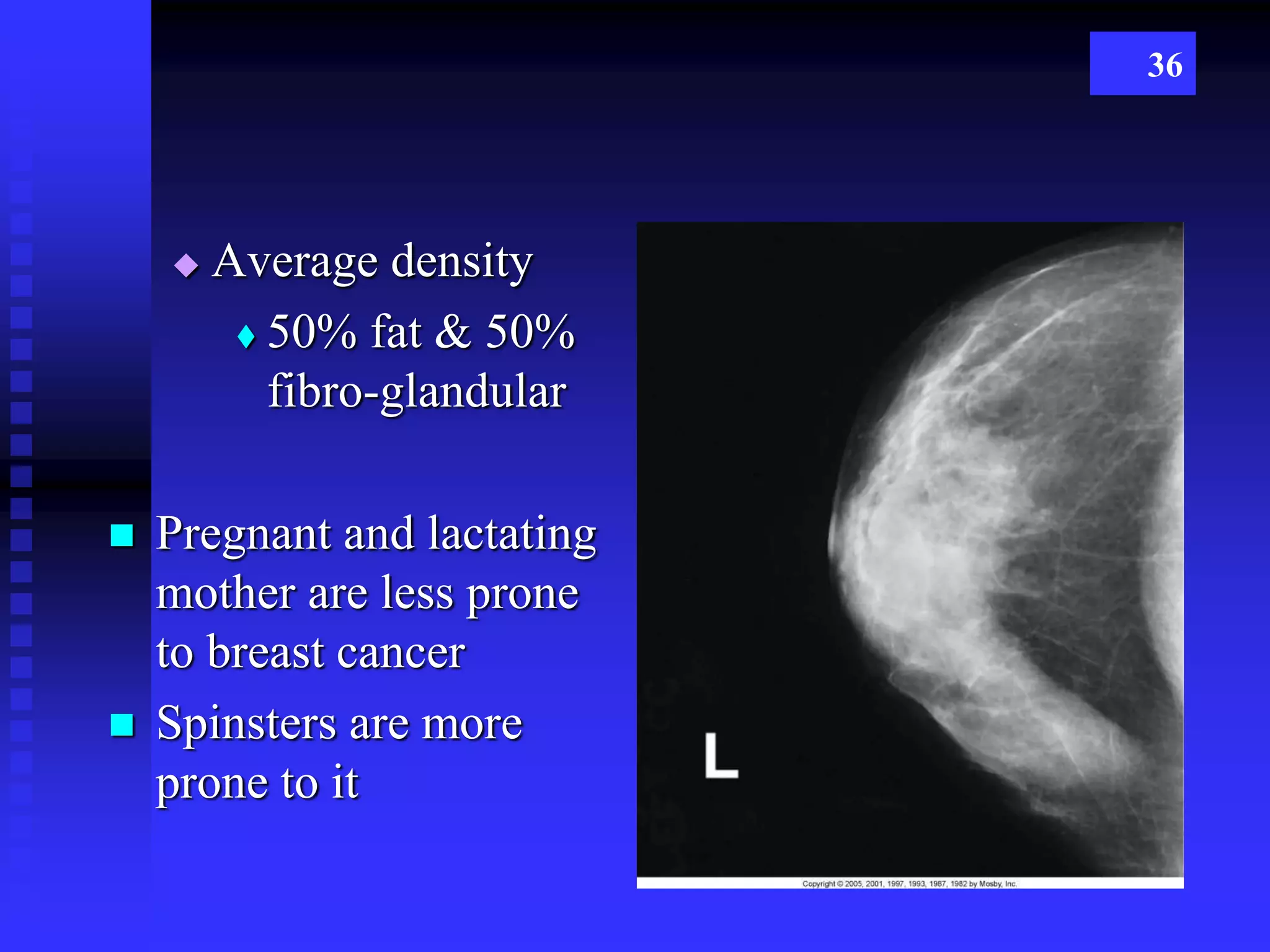 Mammography | PPTX