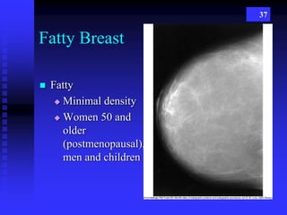37
Fatty Breast
 Fatty
 Minimal density
 Women 50 and
older
(postmenopausal),
men and children
 