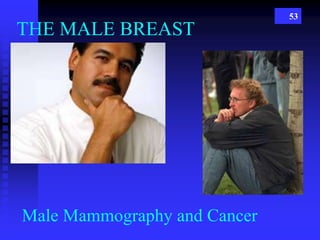 53
THE MALE BREAST
Male Mammography and Cancer
 