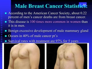 54
Male Breast Cancer Statistics:
 According to the American Cancer Society, about 0.22
percent of men’s cancer deaths are from breast cancer.
 This disease is 100 times more common in women than
it is in men.
 Benign excessive development of male mammary gland
 Occurs in 40% of male cancer pt’s
 Survival rates with treatment are 97% for 5 years
 