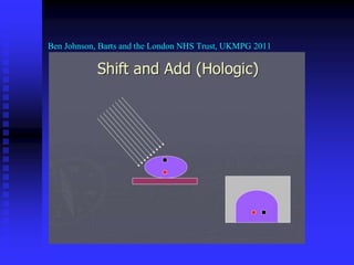 Ben Johnson, Barts and the London NHS Trust, UKMPG 2011
 