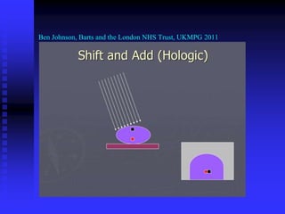 Ben Johnson, Barts and the London NHS Trust, UKMPG 2011
 