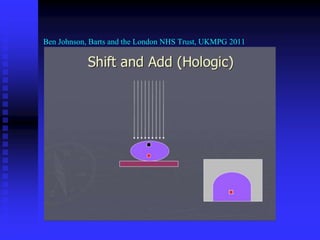 Ben Johnson, Barts and the London NHS Trust, UKMPG 2011
 