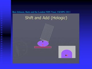 Ben Johnson, Barts and the London NHS Trust, UKMPG 2011
 